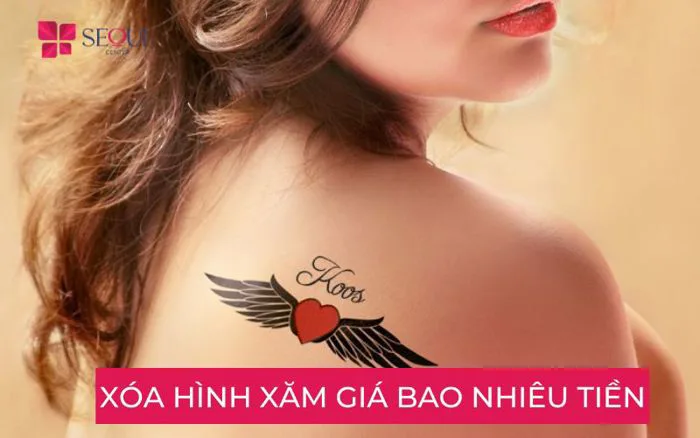 Xóa hình xăm bao nhiêu tiền? Bảng giá theo kích thước T9.2026
